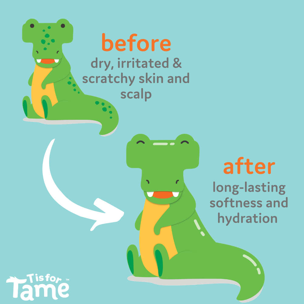 T is for Tame - Scalp Soothing Cream