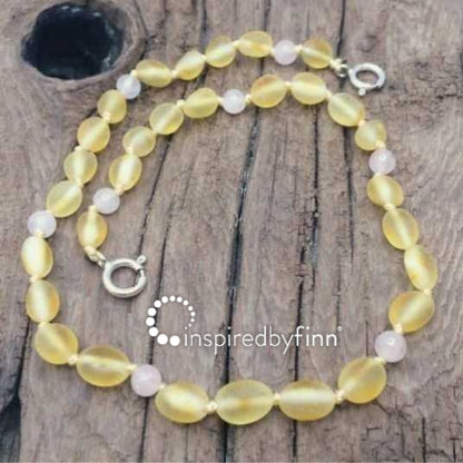 Inspired by Finn - NEW! 11" Baltic Amber Anklet Adjustable Unpolished Lemon Rose Quartz