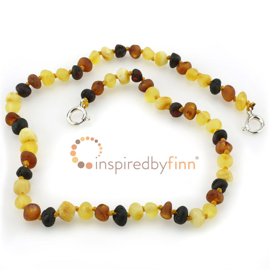 Inspired by Finn - Baltic Amber Anklet - Adjustable Unpolished Diversity